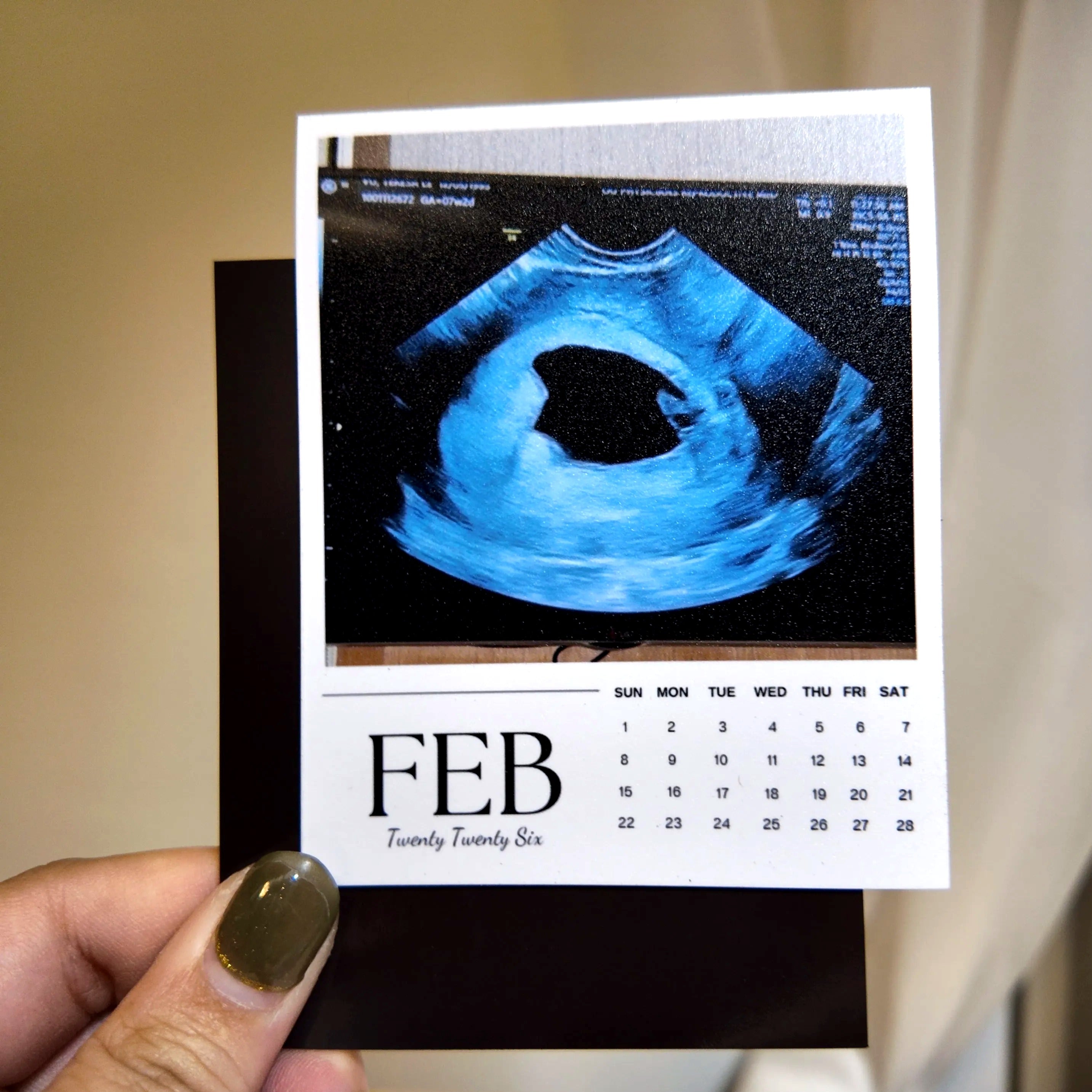 A person's hand holding a calendar featuring an Ultrasound image for the month of February.