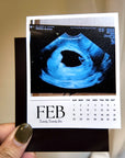 A person's hand holding a calendar featuring an Ultrasound image for the month of February.